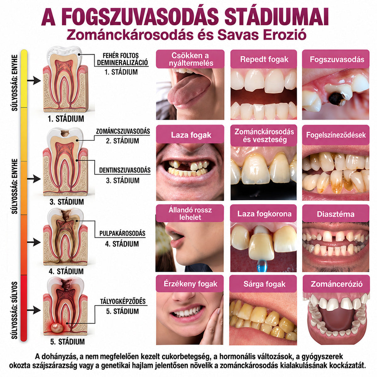 𝐓𝐫𝐢𝐥𝐮𝐦𝐢𝐚® 𝐃𝐞𝐧𝐏𝐞𝐫𝐦 𝐒𝐳𝐮𝐯𝐚𝐬𝐨𝐝á𝐬𝐭 𝐇𝐞𝐥𝐲𝐫𝐞á𝐥𝐥í𝐭ó, 𝐓𝐞𝐫𝐦é𝐬𝐳𝐞𝐭𝐞𝐬 𝐅𝐨𝐠𝐳𝐨𝐦á𝐧𝐜‑𝐏ó𝐭𝐥ó 𝐆é𝐥