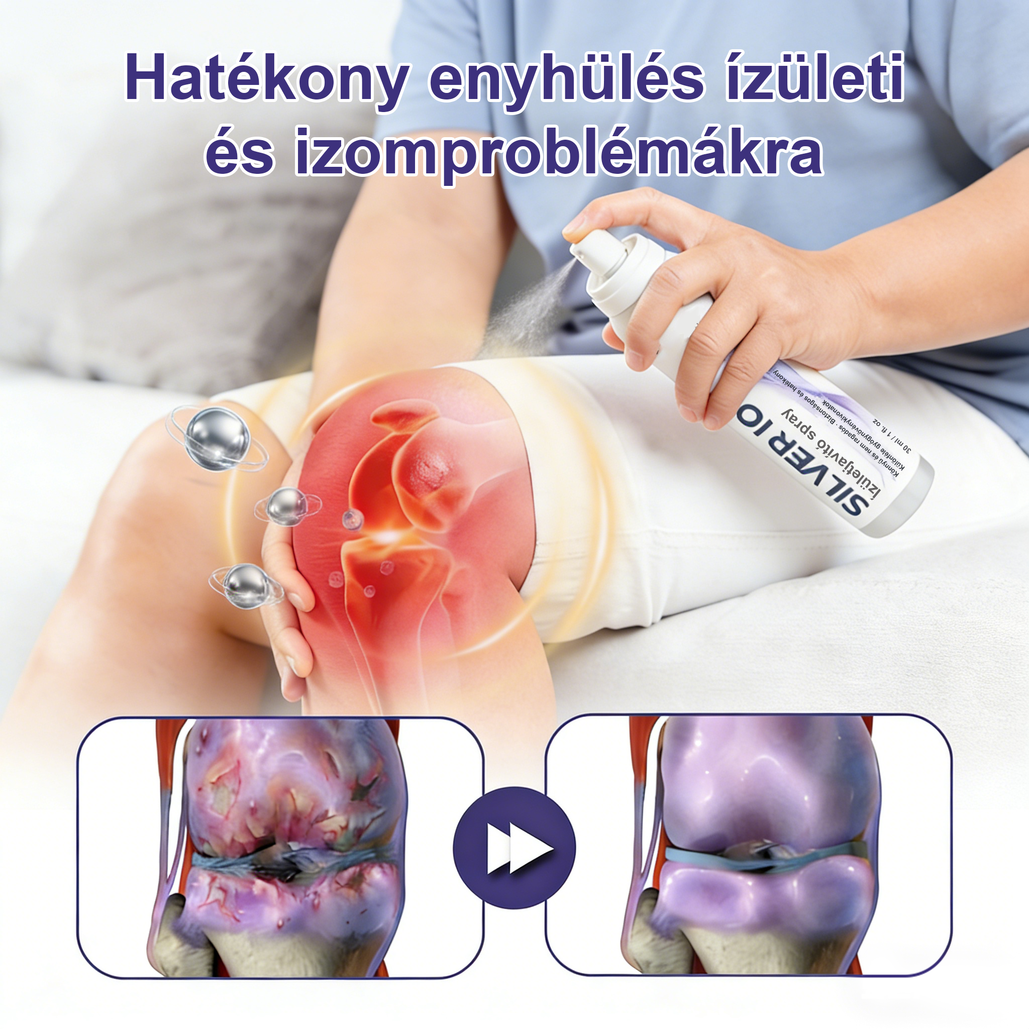 Timnlik® Ezüstionos ízületjavító spray💙