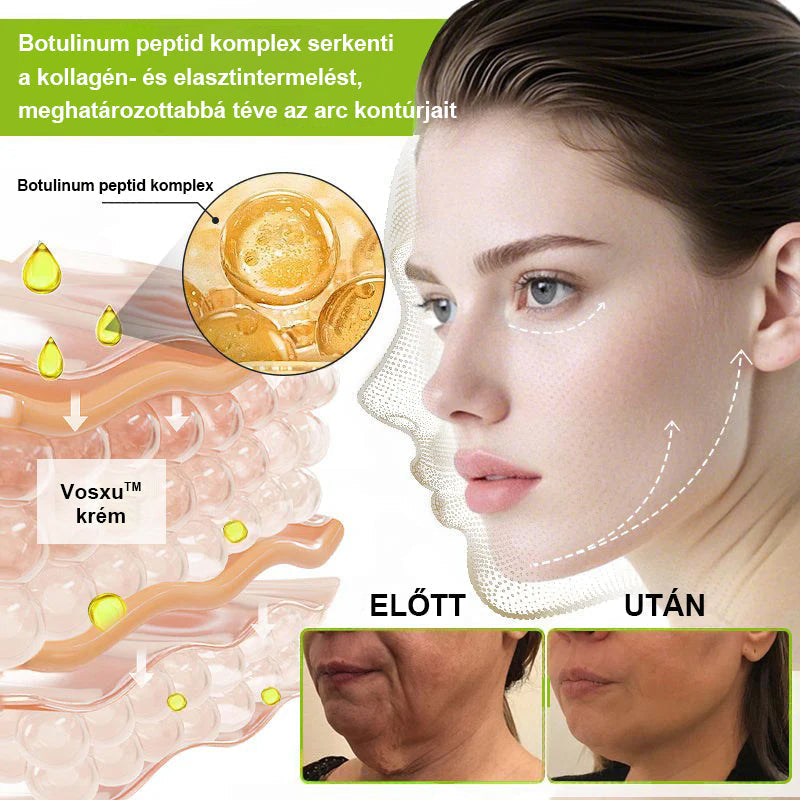 ✨ Vosxu™ Botox & Vita-A Retinol Shot ráncfelvarró szérum ✨ – 💉 Mikro-tűk | 💪 Botox-szerű peptidek | 🌿 Retinol | ⚡ Látható eredmények már 3 nap alatt 🌸