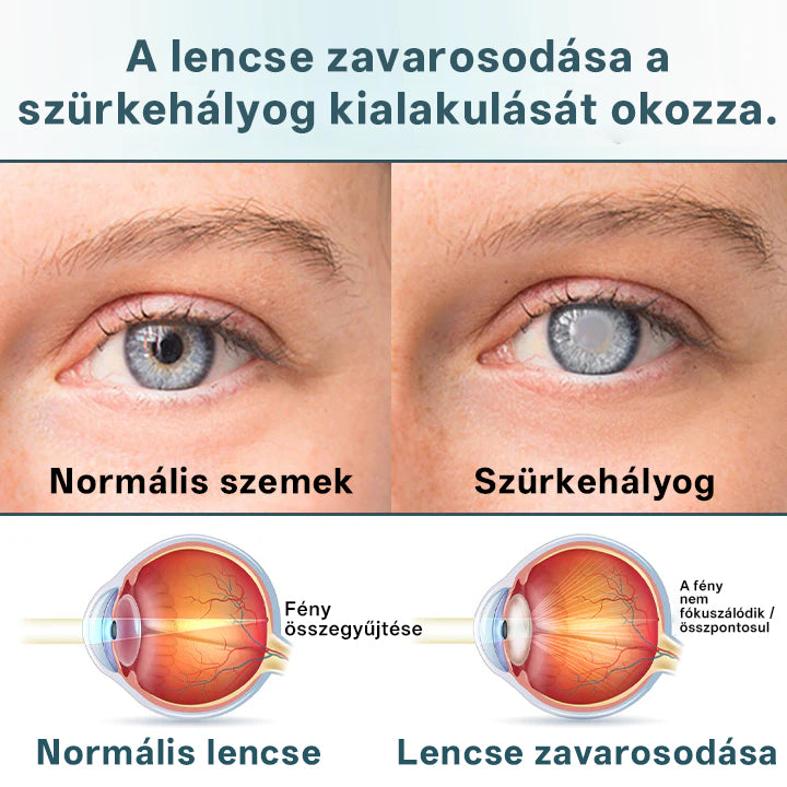 🔥🔥🔥Laleia® OptiFusion Nano szemcsepp szérum🎉
