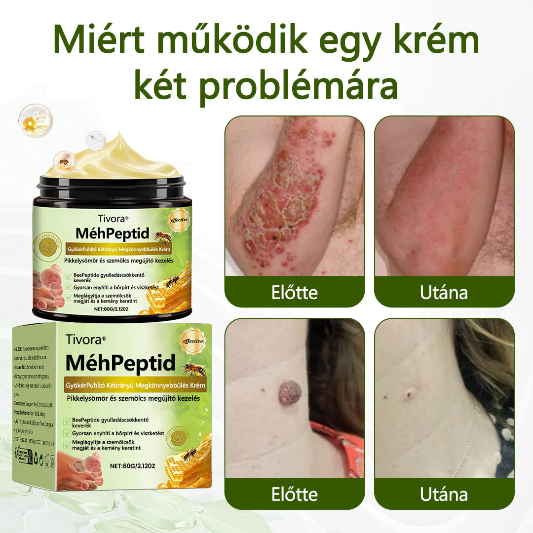 Tivora®✨ MéhPeptid GyökérPuhító Kétirányú Megkönnyebbülés Krém