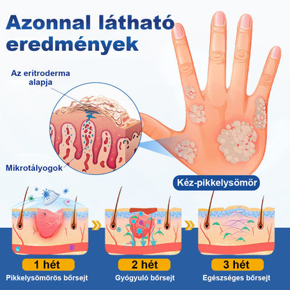 CleraNaure® PsoriaMucin Dörzsölésmentes Viszketés- és Pikkelyenyhítő Permet🎁
