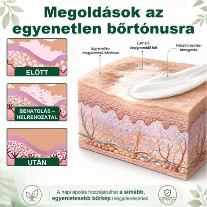 💎CleraNaure® Növényi Vitiligo Krém