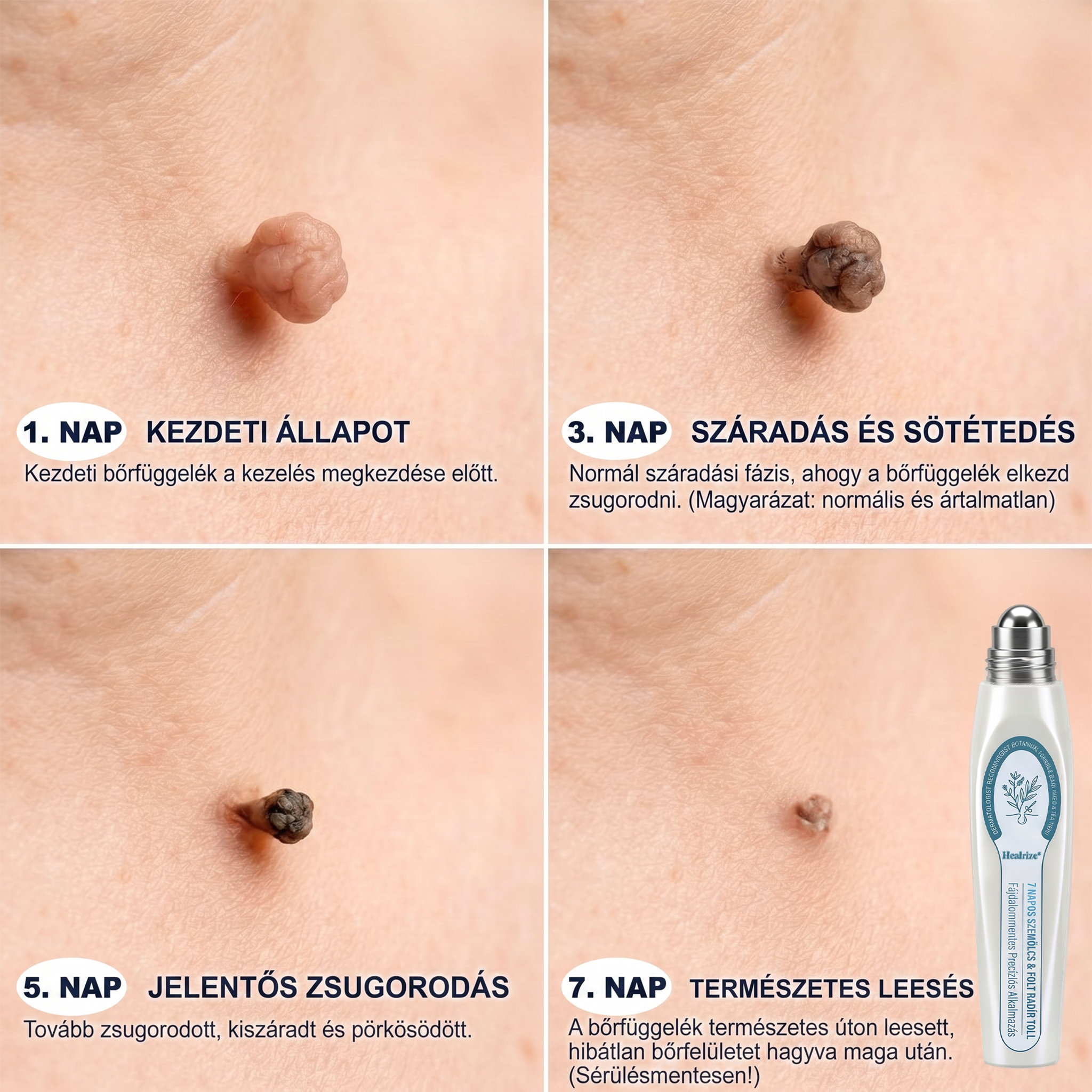 Healrize® Bőrhibák Ápoló Roll-On Egyszerű otthoni használat🎁