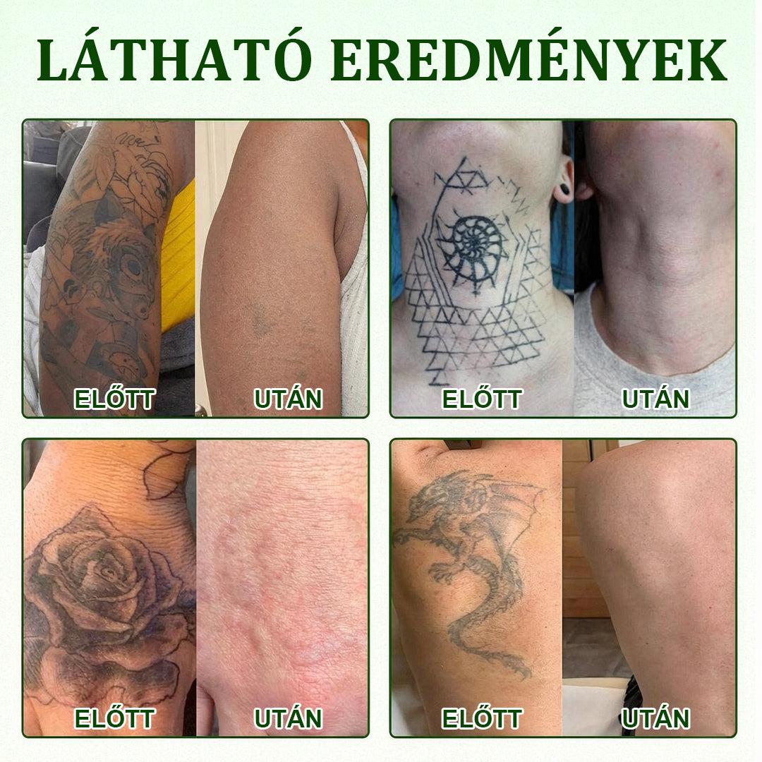 🛡️CleraNaure® Tiszta Algás Festékeltávolító Támogató Spray 🌿 — Búcsúzz el a régi tetoválópigmentektől 💚, Halványítsd a makacs festéket ✨, Helyreállítja és kisimítja a kezelt bőrt 💧, Lézermentes ✅, Próbáld ki most! 🔥