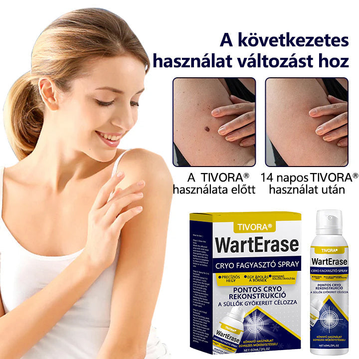 Tivora® WartErase – Fagyasztó Szemölcseltávolító Spray❄️