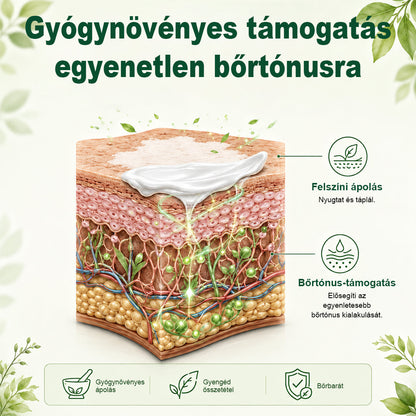 💎CleraNaure® Növényi Vitiligo Krém
