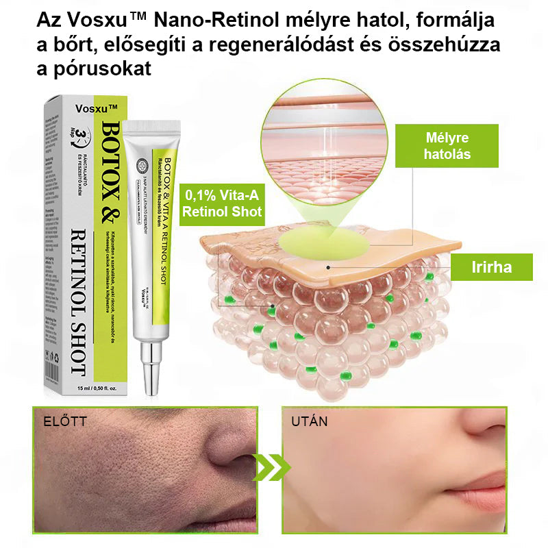 ✨ Vosxu™ Botox & Vita-A Retinol Shot ráncfelvarró szérum ✨ – 💉 Mikro-tűk | 💪 Botox-szerű peptidek | 🌿 Retinol | ⚡ Látható eredmények már 3 nap alatt 🌸