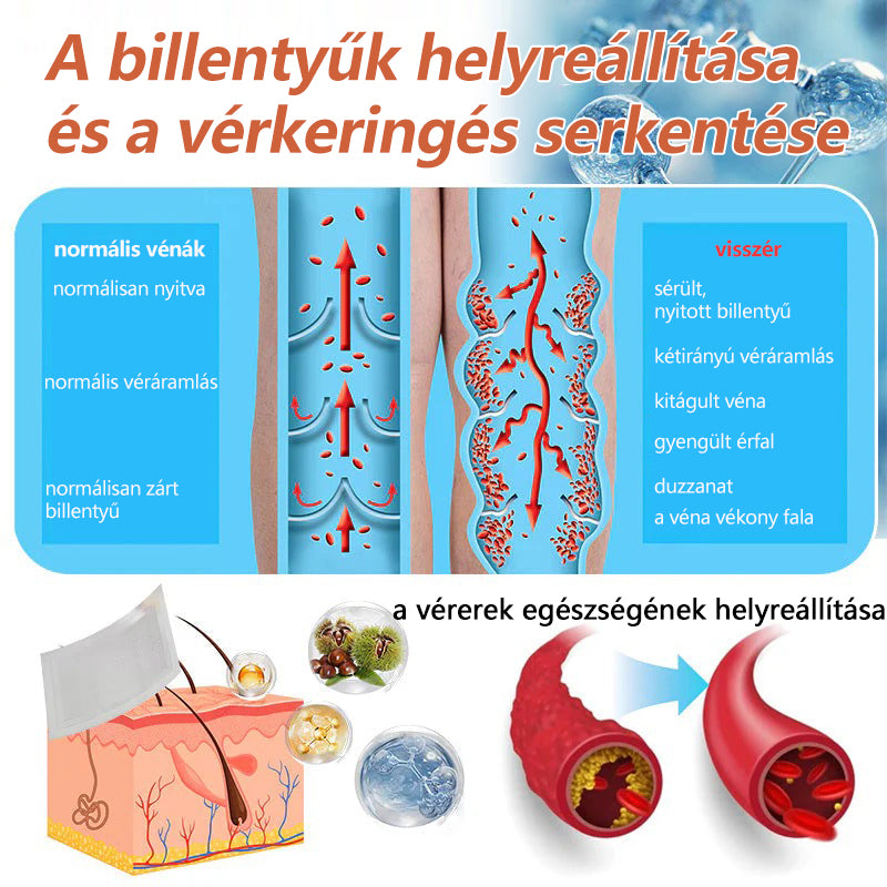 ☘️ Zvoevo® Vein Ease mikro-tűs ápoló tapasz (pókgerincvénák, visszér, duzzanat, fáradt lábak kezelésére)