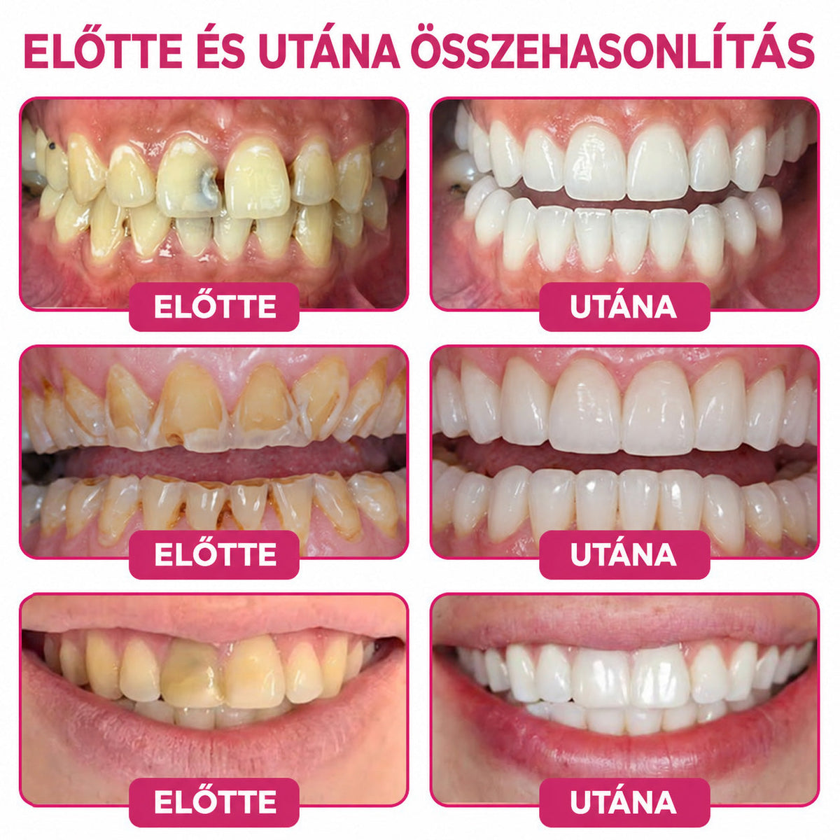 𝐓𝐫𝐢𝐥𝐮𝐦𝐢𝐚® 𝐃𝐞𝐧𝐏𝐞𝐫𝐦 𝐒𝐳𝐮𝐯𝐚𝐬𝐨𝐝á𝐬𝐭 𝐇𝐞𝐥𝐲𝐫𝐞á𝐥𝐥í𝐭ó, 𝐓𝐞𝐫𝐦é𝐬𝐳𝐞𝐭𝐞𝐬 𝐅𝐨𝐠𝐳𝐨𝐦á𝐧𝐜‑𝐏ó𝐭𝐥ó 𝐆é𝐥
