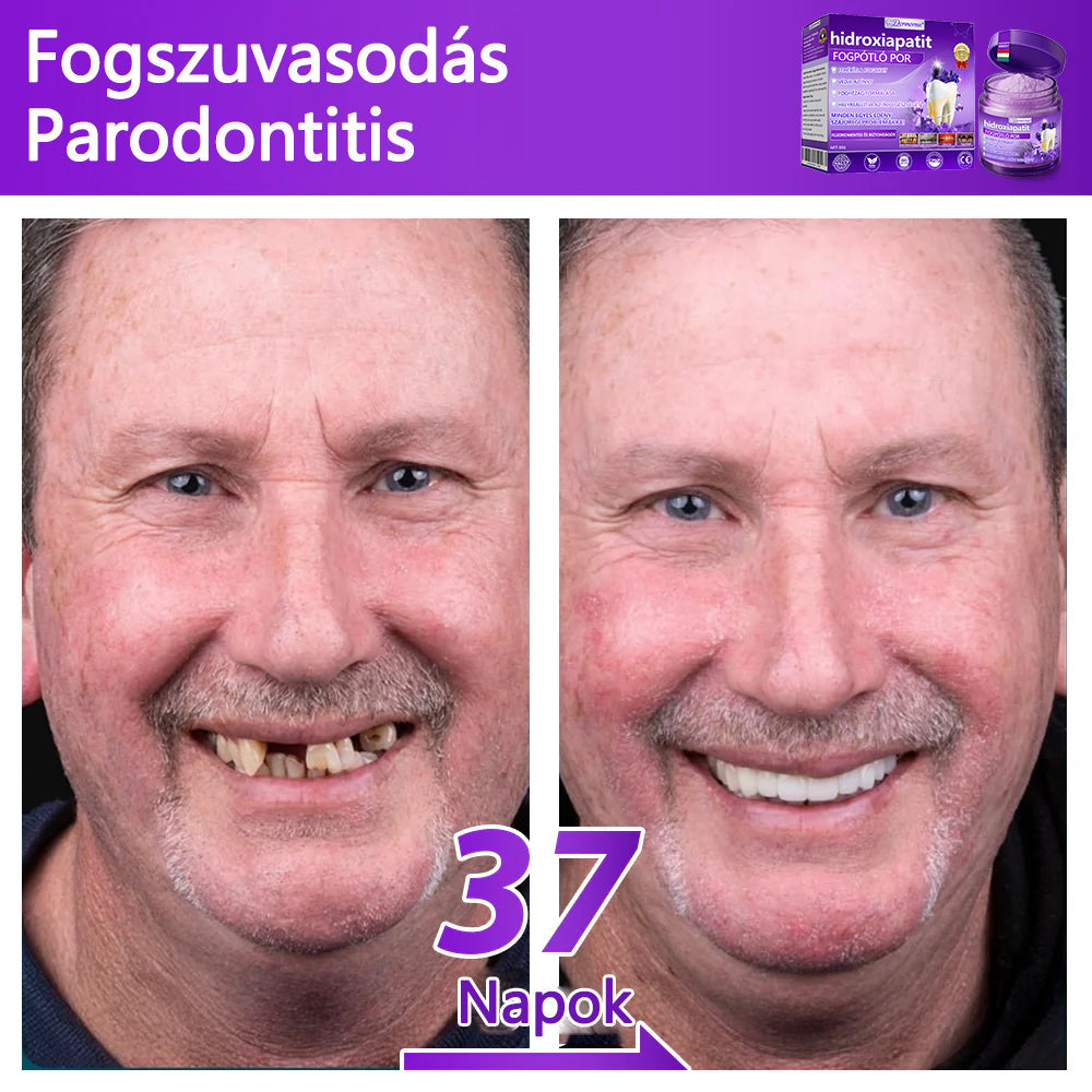 𝐷𝑜𝒓𝒎𝒐𝒓𝑛𝑎® Fogregeneráló és -javító por hidroxiapatittal 🦷 (hatékonyan javítja a fogszuvasodást, az ínyproblémákat, a fogak túlérzékenységét, a szájfekélyeket és a fogak sárgulását, átfogóan javítva a szájhigiéniát) 🍀