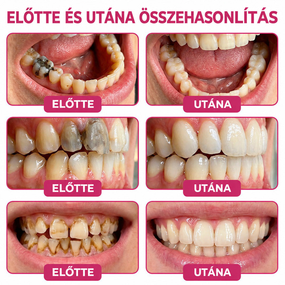 𝐓𝐫𝐢𝐥𝐮𝐦𝐢𝐚® 𝐃𝐞𝐧𝐏𝐞𝐫𝐦 𝐒𝐳𝐮𝐯𝐚𝐬𝐨𝐝á𝐬𝐭 𝐇𝐞𝐥𝐲𝐫𝐞á𝐥𝐥í𝐭ó, 𝐓𝐞𝐫𝐦é𝐬𝐳𝐞𝐭𝐞𝐬 𝐅𝐨𝐠𝐳𝐨𝐦á𝐧𝐜‑𝐏ó𝐭𝐥ó 𝐆é𝐥