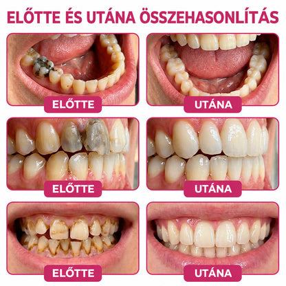 𝐓𝐫𝐢𝐥𝐮𝐦𝐢𝐚® 𝐃𝐞𝐧𝐏𝐞𝐫𝐦 𝐒𝐳𝐮𝐯𝐚𝐬𝐨𝐝á𝐬𝐭 𝐇𝐞𝐥𝐲𝐫𝐞á𝐥𝐥í𝐭ó, 𝐓𝐞𝐫𝐦é𝐬𝐳𝐞𝐭𝐞𝐬 𝐅𝐨𝐠𝐳𝐨𝐦á𝐧𝐜‑𝐏ó𝐭𝐥ó 𝐆é𝐥