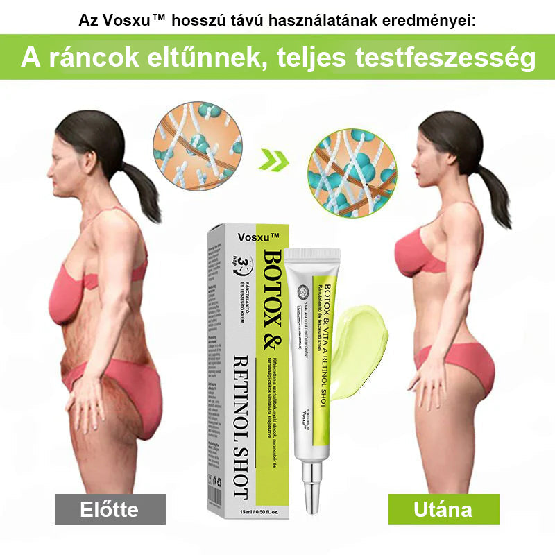 ✨ Vosxu™ Botox & Vita-A Retinol Shot ráncfelvarró szérum ✨ – 💉 Mikro-tűk | 💪 Botox-szerű peptidek | 🌿 Retinol | ⚡ Látható eredmények már 3 nap alatt 🌸