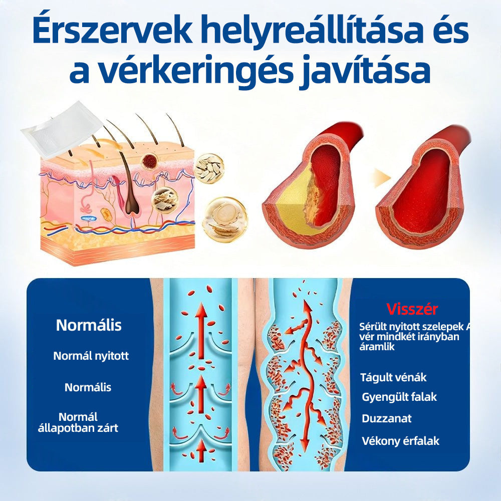 🇭🇺𝐇𝐞𝐚𝐥𝐫𝐢𝐳𝐞® 👩‍⚕️👩‍⚕️VeinTarget mikrotűs tapasz⚡☑️Azonnali enyhülés hosszú távú eredmények