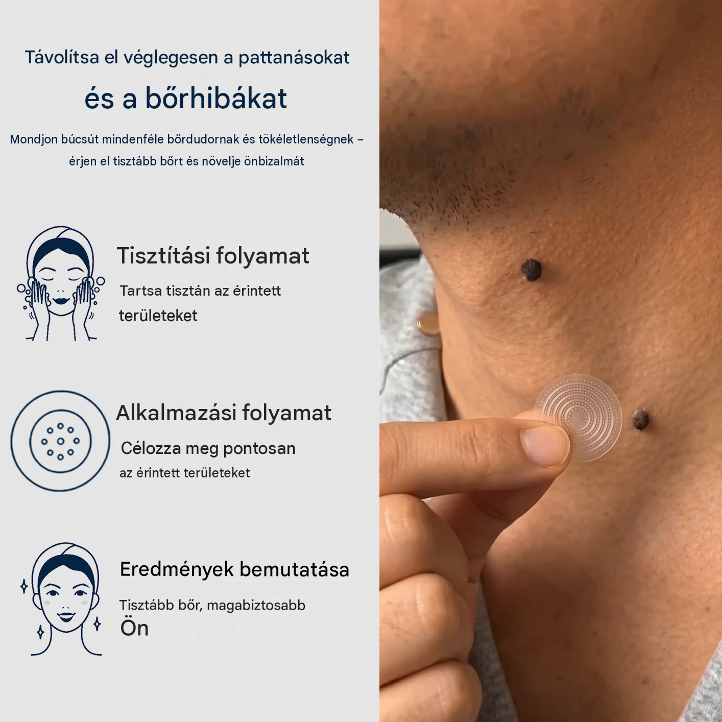 Healrize® 2 az 1-ben mikrotűs hidrogél tapaszok | Eltávolítja a kiemelkedő anyajegyeket, aknét, lapos szemölcsöket és a lágy fibromákat (bőrkinövéseket)🎁