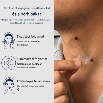 Healrize® 2 az 1-ben mikrotűs hidrogél tapaszok | Eltávolítja a kiemelkedő anyajegyeket, aknét, lapos szemölcsöket és a lágy fibromákat (bőrkinövéseket)🎁
