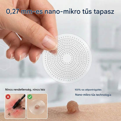 Healrize® 2 az 1-ben mikrotűs hidrogél tapaszok | Eltávolítja a kiemelkedő anyajegyeket, aknét, lapos szemölcsöket és a lágy fibromákat (bőrkinövéseket)🎁
